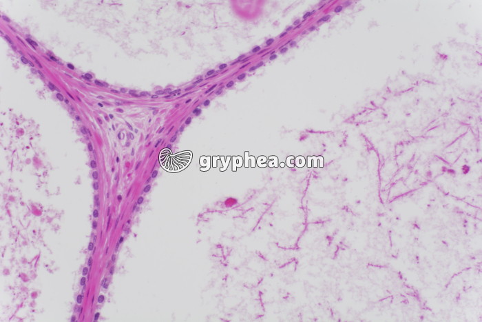 Prostate x100 - gryphea.com